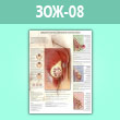 Плакат «Доброкачественные заболевания молочных желез» (ЗОЖ-08, ламинир. бумага, A1, 1 лист)